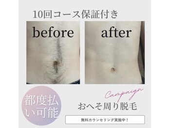 ネクスト 伊勢店(NEXT)/おへそ周り