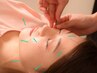 【美活体験】美容鍼灸＋カウンセリング