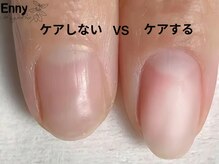 モチの良さが自慢！モチを重視した高技術施術