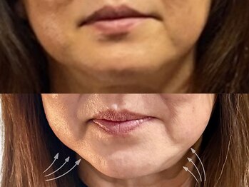 ハス(hasu.)/四角からＶへ