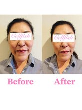 セルフィッシュ(Cellfish)/お顔のコンプレックス改善