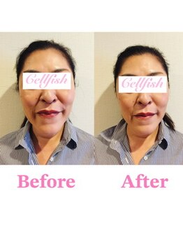 セルフィッシュ(Cellfish)/お顔のコンプレックス改善