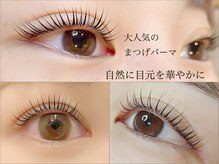フランセス(Frances)の雰囲気（瞳に光が入るようになって綺麗な目に☆）