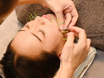 アポヨ鍼灸院(APOYO鍼灸院)の写真/ブライダル小顔＆美姿勢でどの角度から見られても自信が持てるフェイスラインに導きます！