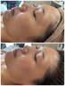 美肌と小顔のフルパックで極上時間◎小顔矯正×リフトアップ