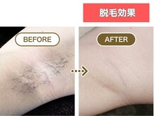 HGB 東山公園駅前店/女性｜20代｜会社員