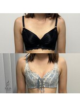 ジュリア(JULIA)/【バストアップ/育乳　症例】