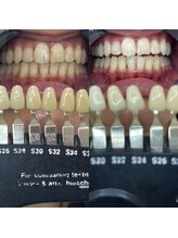 トウキョウスワーズ 池袋店(TOKYO SWRS)/#ホワイトニング #池袋 #渋谷