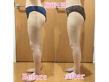 ヨサパーク サーナ(YOSAPARK Sana)の雰囲気（体脂肪削減!!全身むくみケア☆フォトギャラリーご覧ください♪）