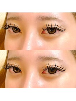 シャルム(Charme)/バインドロック