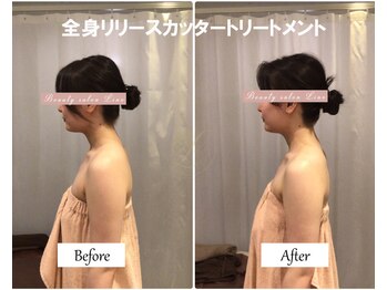 リノ(Lino)/巻き肩、姿勢改善♪