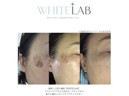 メイリー(Maylie)の写真