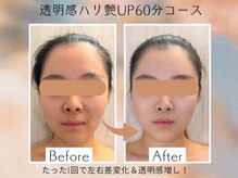 バービーフェイス 恵比寿(Barbie Face)/透明感ハリ艶UP60分コース