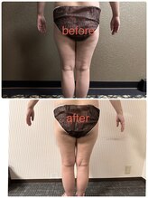 チュラ/ハイパーナイフ/所沢/痩身エステ