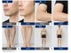 チュー 中目黒(chuu)の写真/【メンズ髭脱毛(鼻下、頬、顎、頬)初回¥2,500】ストレスない清潔感のあるお肌へ導きます♪