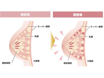 エムスタイル(M.style)/#1 「フォトバスト施術」