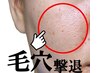頬の毛穴つるん♪たるみ＆開き毛穴引き締め集中コース¥8,800→¥7,700