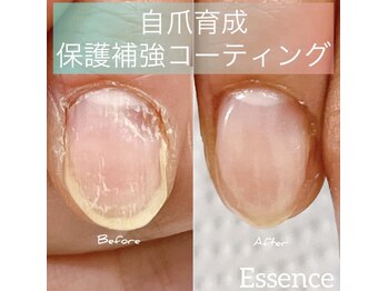 エッセンス (Essence)/お悩み爪も改善◎ご相談ください