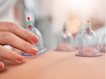 りらく もみのき 清水店/カッピング