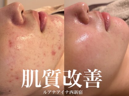 ルアナアイナ(Luana Aina)の写真