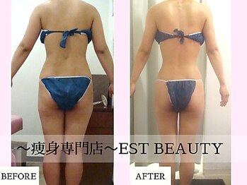 エストビューティー 池袋店(EST BEAUTY)の写真/【口コミ高評価◎痩身といえばココ！】セル脂肪を分解！憧れの韓国アイドル級の華奢BODYを目指しましょう♪