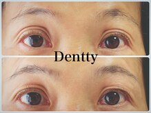 ネイルサロン デンティ(Dentty)/HBL(眉癖改善＋眉毛Wax)