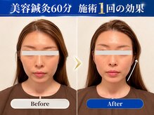 トウヨウビジン 美容鍼灸サロン(TOYO BIJIN)