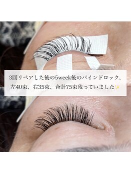 グラッディ(Glady)/バインドロック50束付け足し