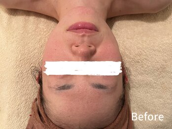 ダイヤモンド リーエンダ(Diamond leende)/クレイハーブピーリング