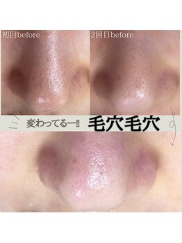 プアラ(puala)/beforeでも違う!