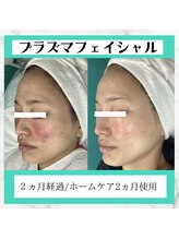 ヴィヴ 熊本(ViV)/