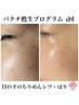 【最新美容★次世代レチノール】シミ・たるみに★本格エイジングケア 60分