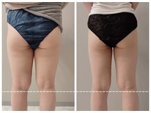 グランディールアン(GRANDIR UN)/下半身痩せ3ヶ月の変化