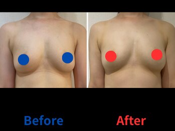 ポインセチア(Poinsettia)/ダイナミックバスト4DX/並び比較