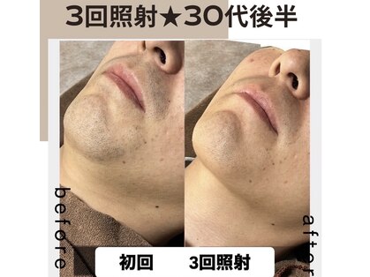 リムル(REMURU)の写真