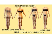 プライベートサロン やすらぎ/症例写真｜エンダモロジー×姿勢