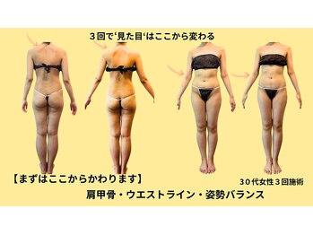 プライベートサロン やすらぎ/症例写真｜エンダモロジー×姿勢