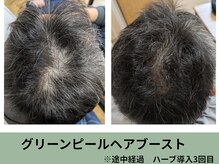 アリー(Alii)/ヘアブースト3回目