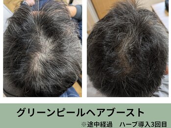 アリー(Alii)/ヘアブースト3回目