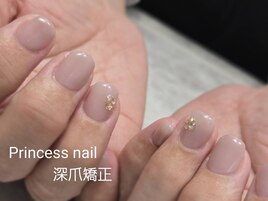 深爪矯正＋ジェルネイル可能
