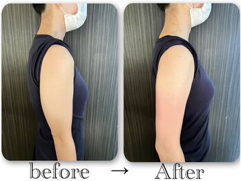 テテ(TeTe)/テテが華奢な二の腕へ導きます♪