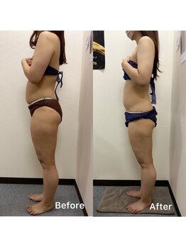 きれい塾 恵比寿/30代３ヶ月後