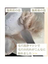 キレイノココロミ(きれいのCoCoRomi)/毛穴洗浄マシン