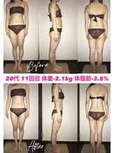 シェイプ 浜松本店/ブライダルエステはシェイプ