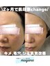 人気No.1【美白/大きい/濃い/多い】うっかり日焼け後の最強メンテナンス