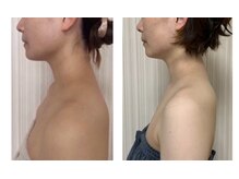 オーラ 美容サロン(AURA)/肩甲骨はがしx小顔美矯正