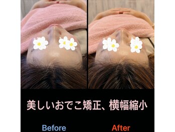 美容矯正サロン レレポノ(LELEPONO)/