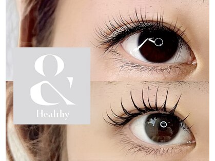 クレイ(CLAY)の写真