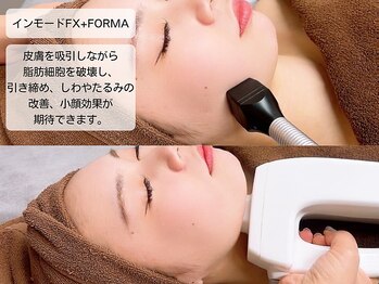 ルディラ 上野店/インモードFX+FORMA