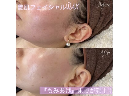 エスト(este.)の写真